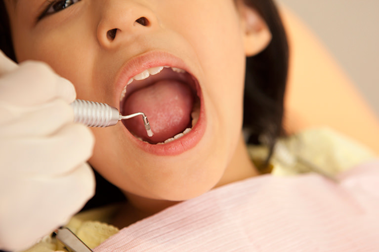 乳歯は生え替わるので、むし歯になっても治療しなくて大丈夫でしょうか?